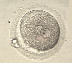 Oocyte with normal fertilization with 2 pronuclei and 2 polar bodies.